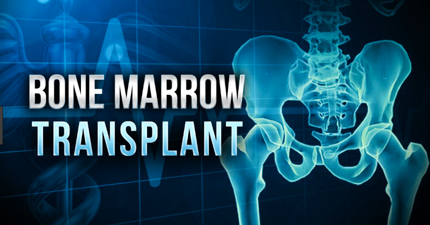 Bone Marrow Transplantation - Online Science Notes