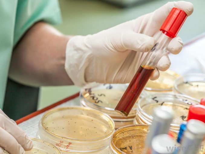 Germ tube formation test (Principle, Procedure, Result Interpretation