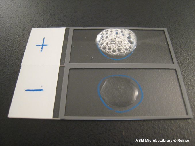 Catalase Test Principle Procedure Result Interpretation And Precautions Online Science Notes 4820