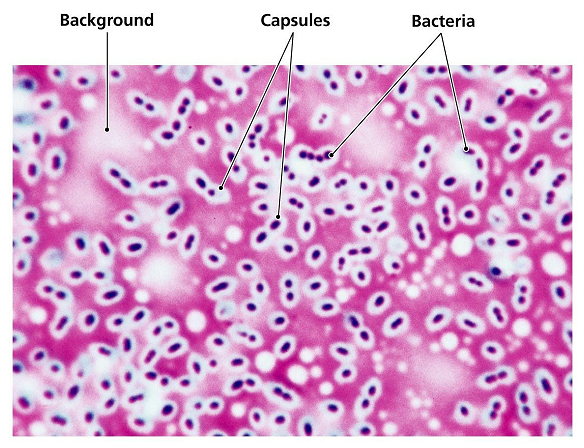 Capsule staining: Principle, Requirements, Procedure and Microscopic