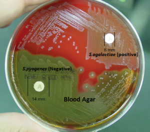 Bacitracin Test or Bacitracin Susceptibility Test (Principle, Procedure